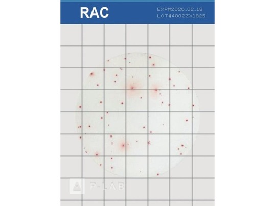 ROTI Easy Count_RAC.jpg