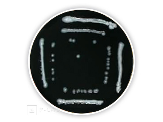 Legionella agar (základ).jpg