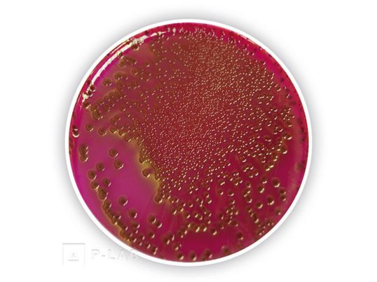 Endo-Agar (základ).jpg