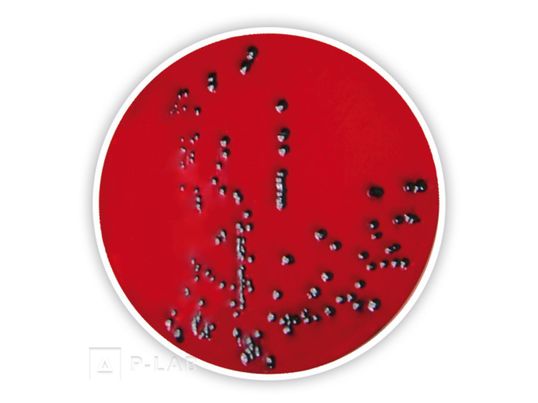 Agar XLD.jpg