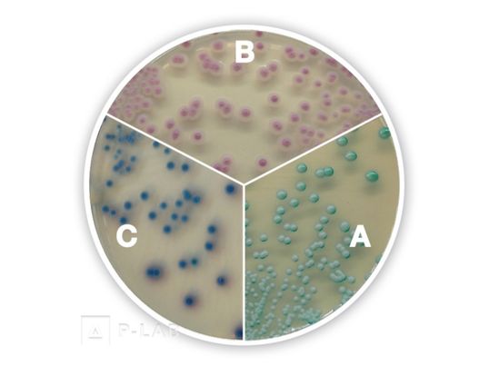 Candida Chromo-Agar.jpg