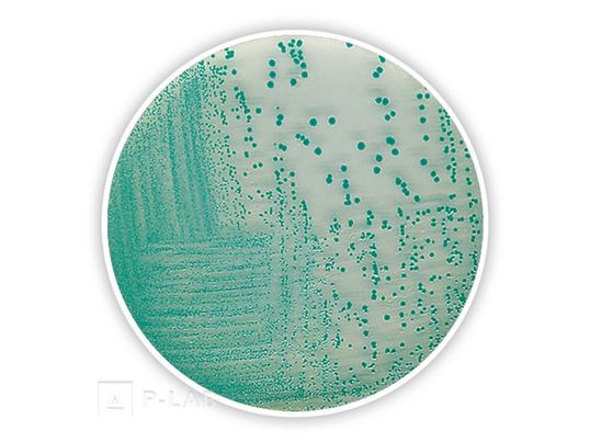 TBX Chromo-Agar.jpg