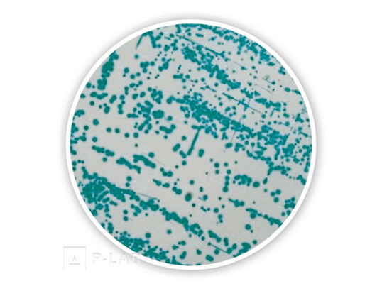 Cronobacter Chromo-agar.jpg