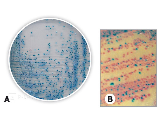 coliformis chromo-agar.jpg